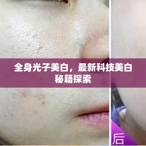 全身光子美白，最新科技美白秘籍探索