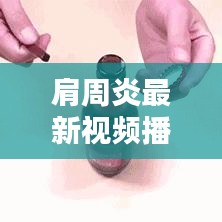 肩周炎最新视频播放图片，全方位解析预防与治疗肩周炎的方法