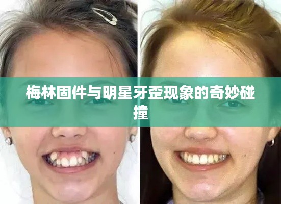 梅林固件与明星牙歪现象的奇妙碰撞