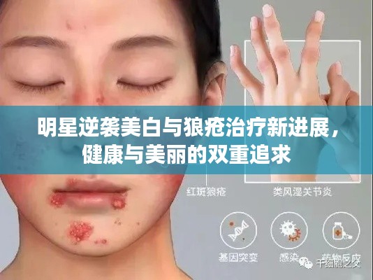 明星逆袭美白与狼疮治疗新进展,健康与美丽的双重追求