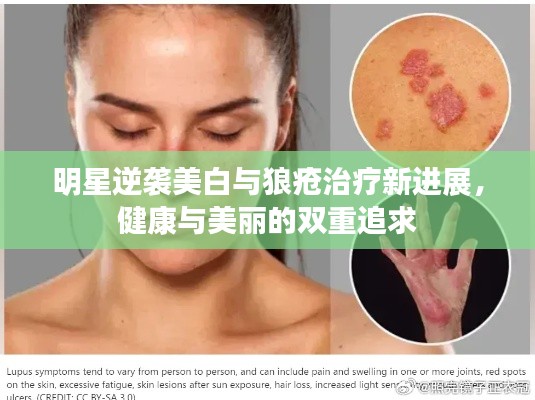 明星逆袭美白与狼疮治疗新进展,健康与美丽的双重追求