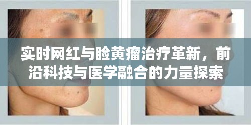 实时网红与睑黄瘤治疗革新，前沿科技与医学融合的力量探索