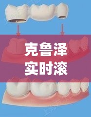 克鲁泽实时滚动数据引领补牙洞市场革新潮流,价格透明与技术革新的并行发展